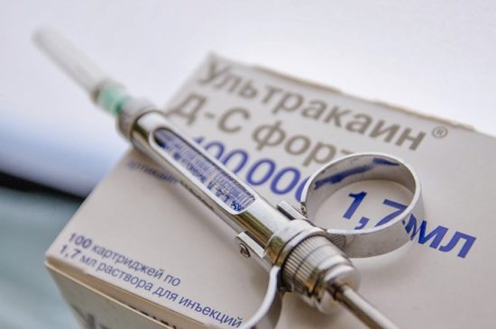 Ультракаин